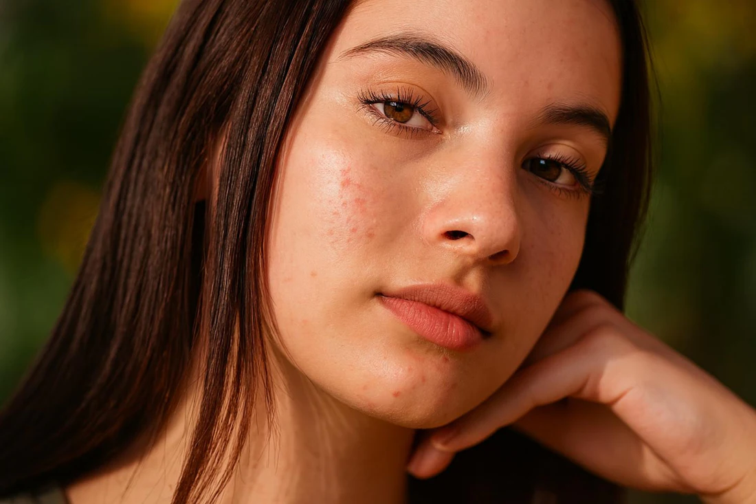 Close-up portrait showing skin after the routine (illustrative)